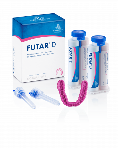 Futar D Occlusion матеріал для фіксації оклюзії