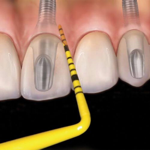 Набір зондів Colorvue #UNC12, 12