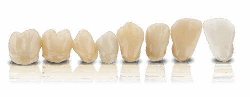 Матеріал VarseoSmile Crown plus A2, 250 g, A2, 250 гр