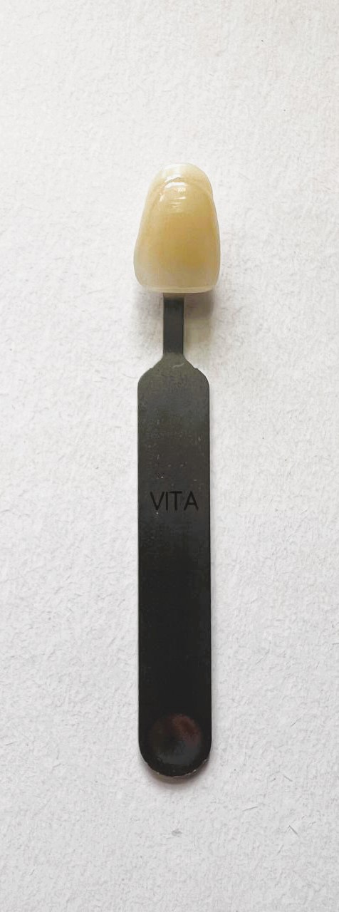 VITA classical – зразок відтінку A4, A4